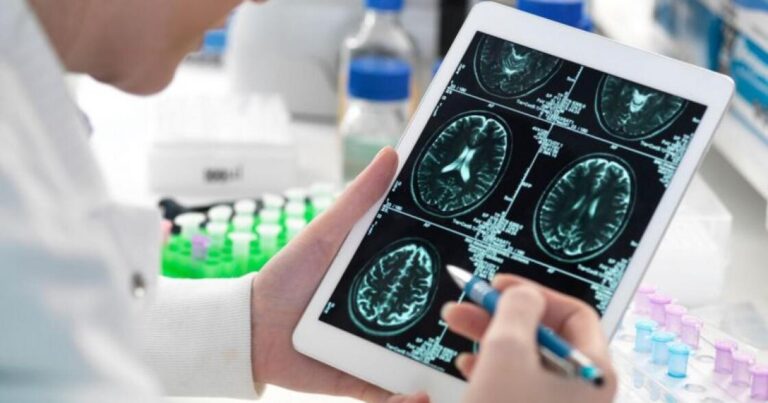 Alzheimerlə mübarizədə yeni ümid Alzheimerlə mübarizədə yeni ümid