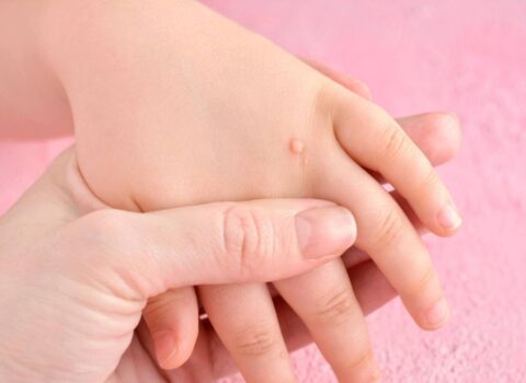 Sarımsaq əzməsini ziyilin üstünə vurun – Yox edəcək