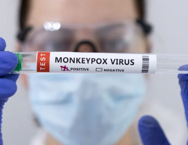 İsraildə aqressiv meymunçiçəyi ştamına ilk yoluxma qeydə alınıb