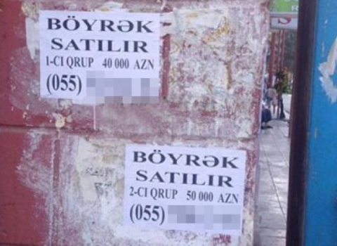 Böyrəyini satmaq istəyən şəxs 6 min manat cərimələndi