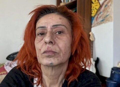 Gözəlliyi ona baha başa gəldi – Yıldız Tilbe danışdı