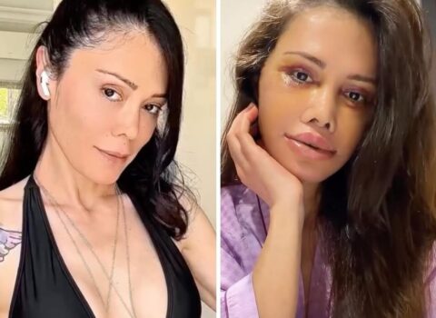 Əməliyyatla üzünü dəyişdirdi, tanınmaz hala düşdü – FOTO