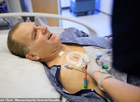 Dünyada ilk: Əvvəl donuz, sonra insan böyrəyi…