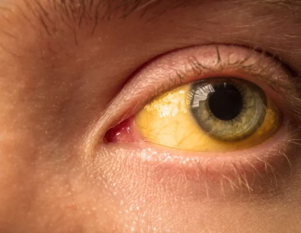 Bu məhsulla bağlı XƏBƏRDARLIQ: Hepatit A və Norovirusa yoluxa bilərsiniz…