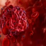 Tromb ola biləcəyini göstərən əsas narahatedici əlamətlər