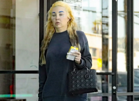 Məşhur aktrisa psixoloji xəstəlikdən sonra – FOTO