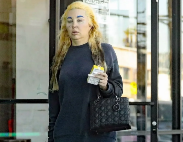 Məşhur aktrisa psixoloji xəstəlikdən sonra – FOTO