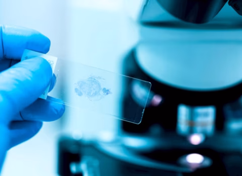 Ağciyər xərçəngi ilə bağlı qorxulu fakt