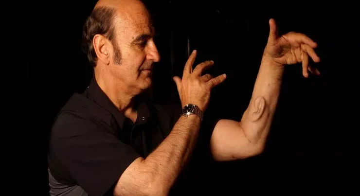 Rəssam əlinə qulaq implantasiya etdi: O, eşidə bilir