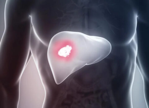 Qaraciyər xərçəngi və sirrozdan qorunmağın ən ucuz yolu: Hər gün bu içkini için