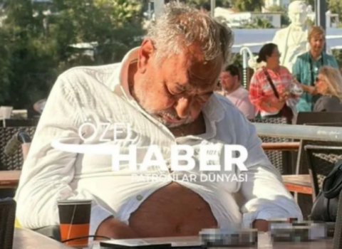 Televiziya ulduzunun son halını görənlər tanıya bilmir – FOTO