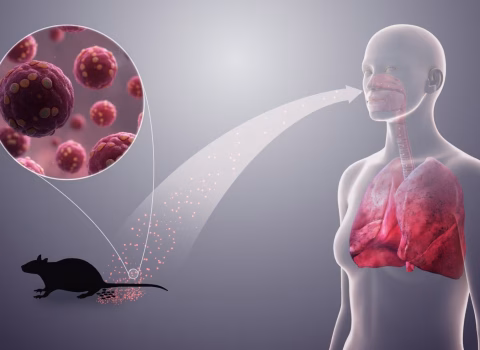 Dünyada Hantavirus təhlükəsi böyüyür: Virusla bağlı elə dəhşətli iddialar yayıldı ki…