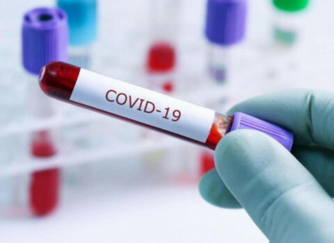 COVID-19-dan ölənlərin sayı 7 milyonu keçdi