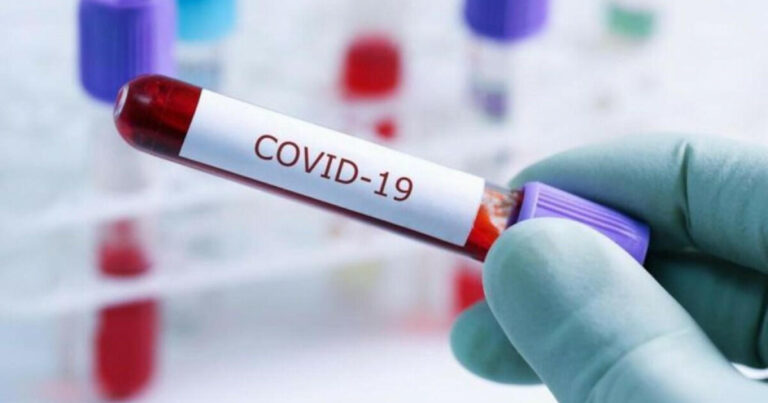COVID-19-dan ölənlərin sayı 7 milyonu keçdi COVID-19-dan ölənlərin sayı 7 milyonu keçdi