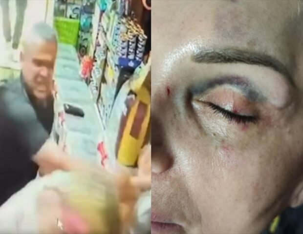 Bakıda kişi qadını mağazada döydü – Saxlanıldı (Video)