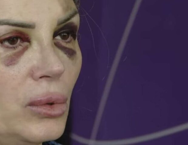 Mağazada döyülən qadın danışdı: “Demişdi ki, səni….” – VİDEO
