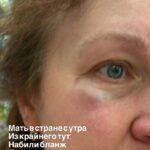 Lvovda ukraynalı hərbçinin anası rus dilində danışdığı üçün döyüldü – Avtobusdan düşürüldü – VİDEO