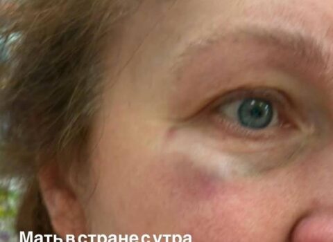 Lvovda ukraynalı hərbçinin anası rus dilində danışdığı üçün döyüldü – Avtobusdan düşürüldü – VİDEO
