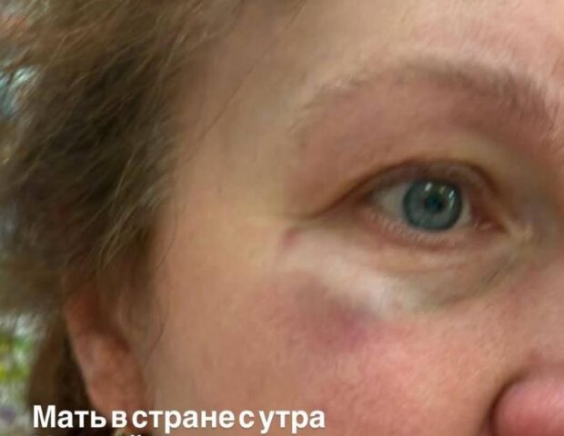 Lvovda ukraynalı hərbçinin anası rus dilində danışdığı üçün döyüldü – Avtobusdan düşürüldü – VİDEO