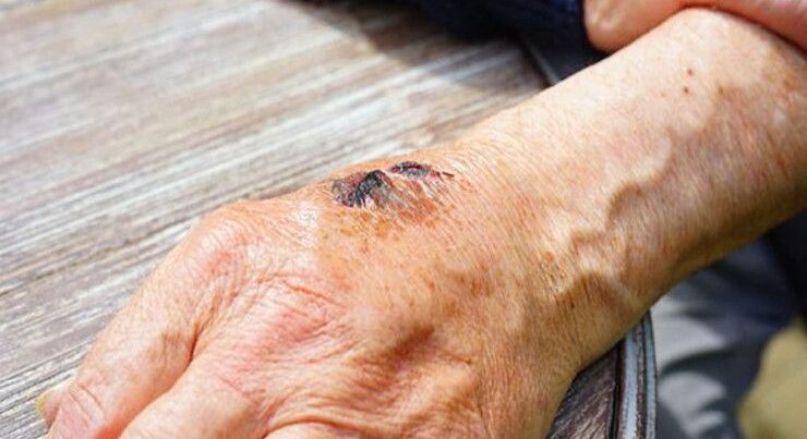 Nazirlik Samuxda baş verən qarayara hadisəsi ilə bağlı məlumat yaydı Nazirlik Samuxda baş verən qarayara hadisəsi ilə bağlı məlumat yaydı
