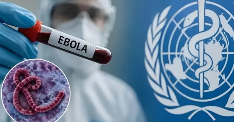 Ebola tarixdə görünməmiş sürətlə yayılır: ÜST-dən HƏYƏCAN TƏBİLİ