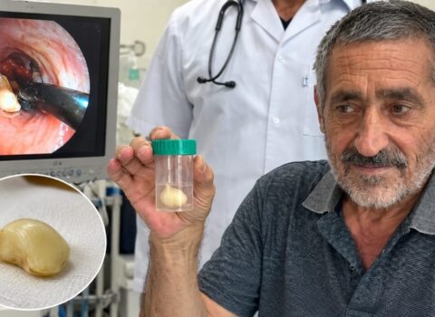 6 ay ağciyərində bu bitki ilə yaşadı – həqiqət xəstəxanada üzə çıxdı