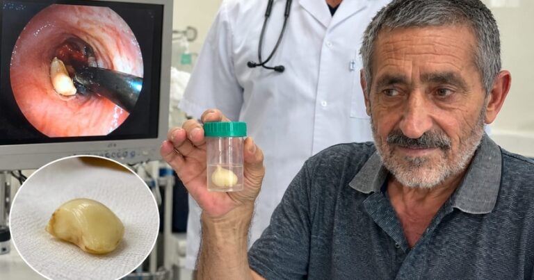 6 ay ağciyərində bu bitki ilə yaşadı – həqiqət xəstəxanada üzə çıxdı